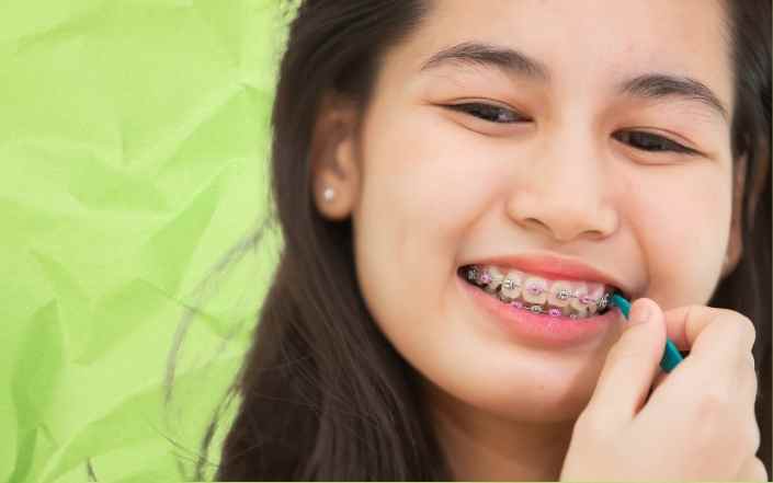 Braces treatment example
