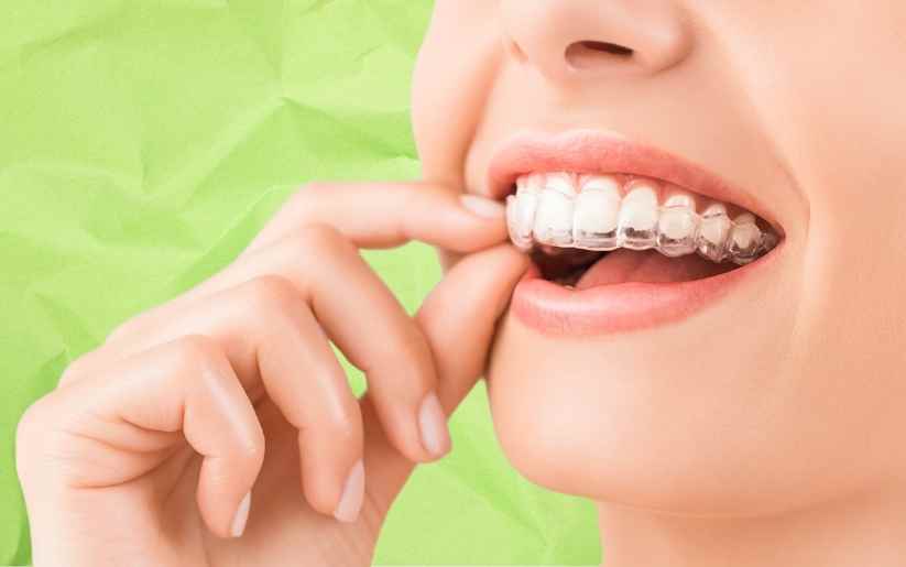 Clear aligner trays displayed beside a bright, straight smile