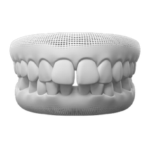 Gapped Teeth