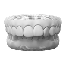 Overbite